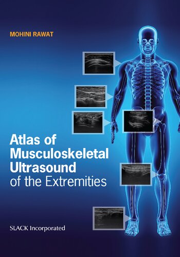 Atlas Of Musculoskeletal Ultrasound Of The Extremities Dr Mohini Rawat