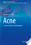 Acne Current Concepts And Management 1st Edition Dae Hun Suh