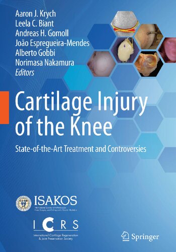 Cartilage Injury Of The Knee Stateoftheart Treatment And Controversies 1st Edition Aaron J Krych