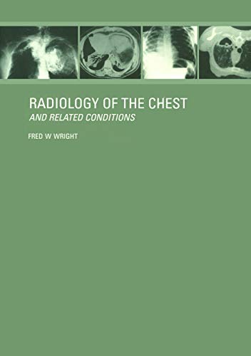 Radiology Of The Chest And Related Conditions 1st Edition F W Wright