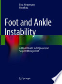 Foot And Ankle Instability A Clinical Guide To Diagnosis And Surgical Management 1st Edition Beat Hintermann