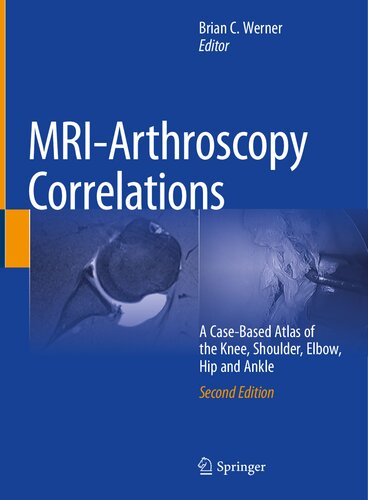 Mriarthroscopy Correlations A Casebased Atlas Of The Knee Shoulder Elbow Hip And Ankle Brian C Werner