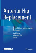 Anterior Hip Replacement From Origin To Current Advanced Techniques Joel Matta