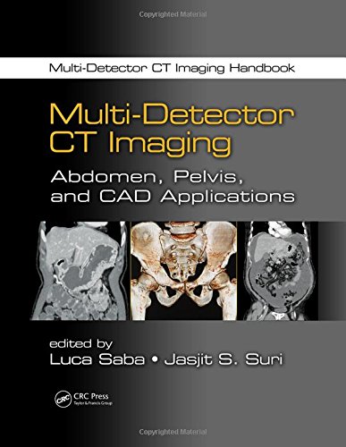 Multidetector Ct Imaging Handbook Two Volume Set Luca Saba Jasjit S Suri