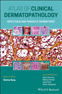 Atlas Of Clinical Dermatopathology Infectious And Parasitic Dermatoses Gnter Burg