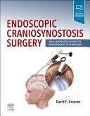 Endoscopic Craniosynostosis Surgery An Illustrated Guide To Endoscopic Techniques David F Jimenez