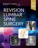 Revision Lumbar Spine Surgery 1st Edition Robert F Heary
