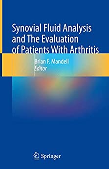 Synovial Fluid Analysis And The Evaluation Of Patients With Arthritis 1st Edition Brian F Mandell
