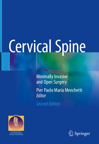 Cervical Spine Minimally Invasive And Open Surgery 2nd Edition Pier Paolo Maria Menchetti Editor