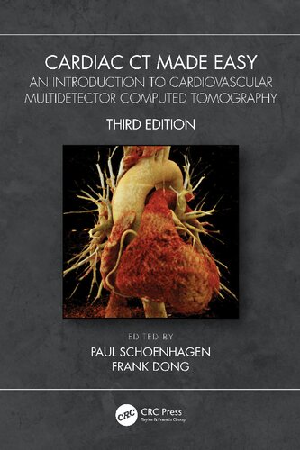 Cardiac Ct Made Easy An Introduction To Cardiovascular Multidetector Computed Tomography 3rd Edition Paul Schoenhagen Editor