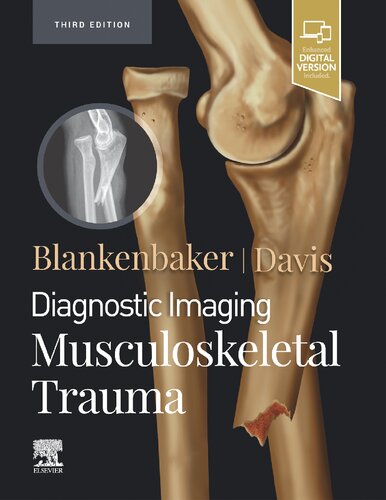 Diagnostic Imaging Musculoskeletal Trauma 3rd Donna G Blankenbaker
