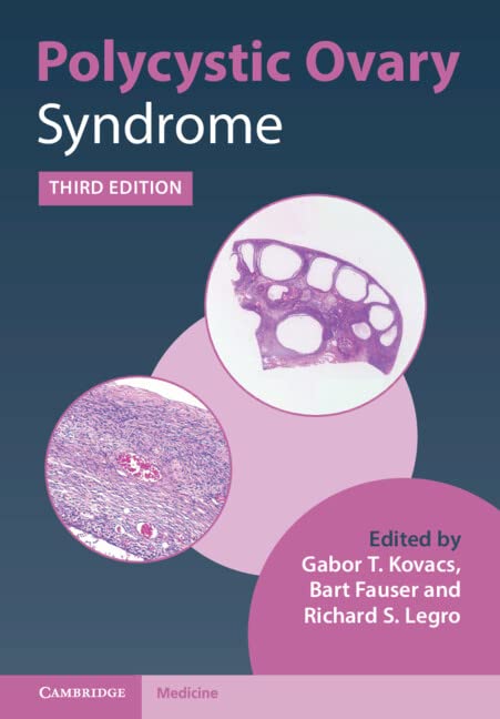 Polycystic Ovary Syndrome 3rd Ed 3rd Edition Gabor T Kovacs