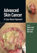 Advanced Skin Cancer A Casebased Approach 1st Debjani Sahni