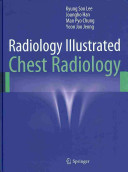 Radiology Illustratedchest Radiology Dec 20 20133642370950springerpdf Kyung Soo Lee