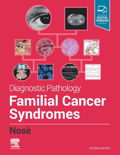 Diagnostic Pathology Familial Cancer Syndromes 2nd Edition Uk