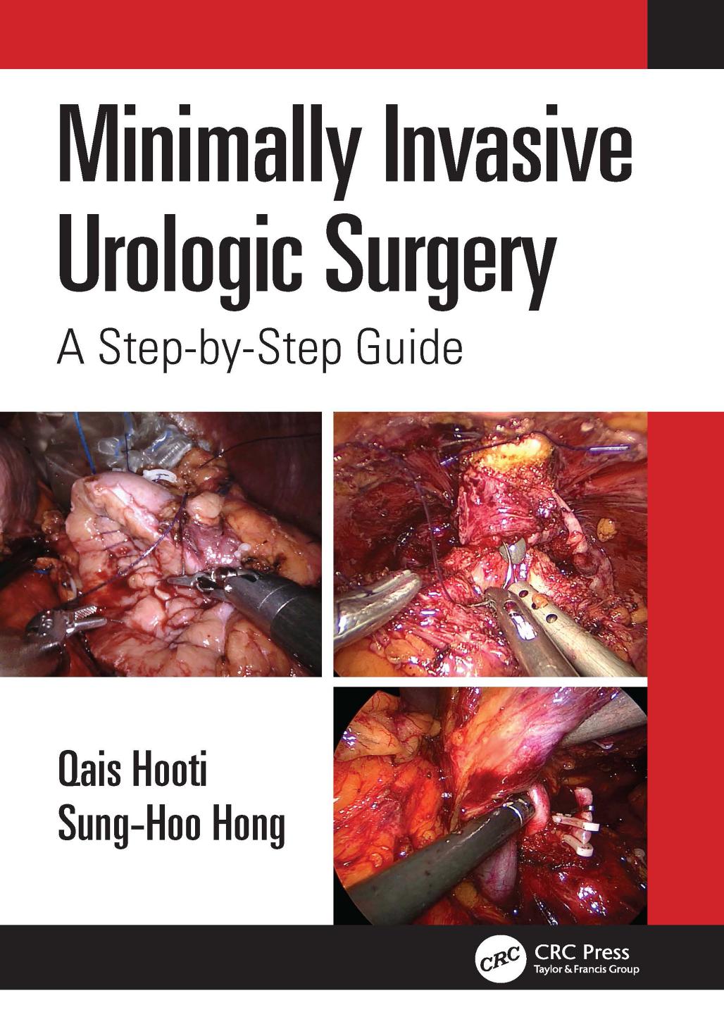 Minimally Invasive Urological Surgery A Stepbystep Guide Qais Hooti