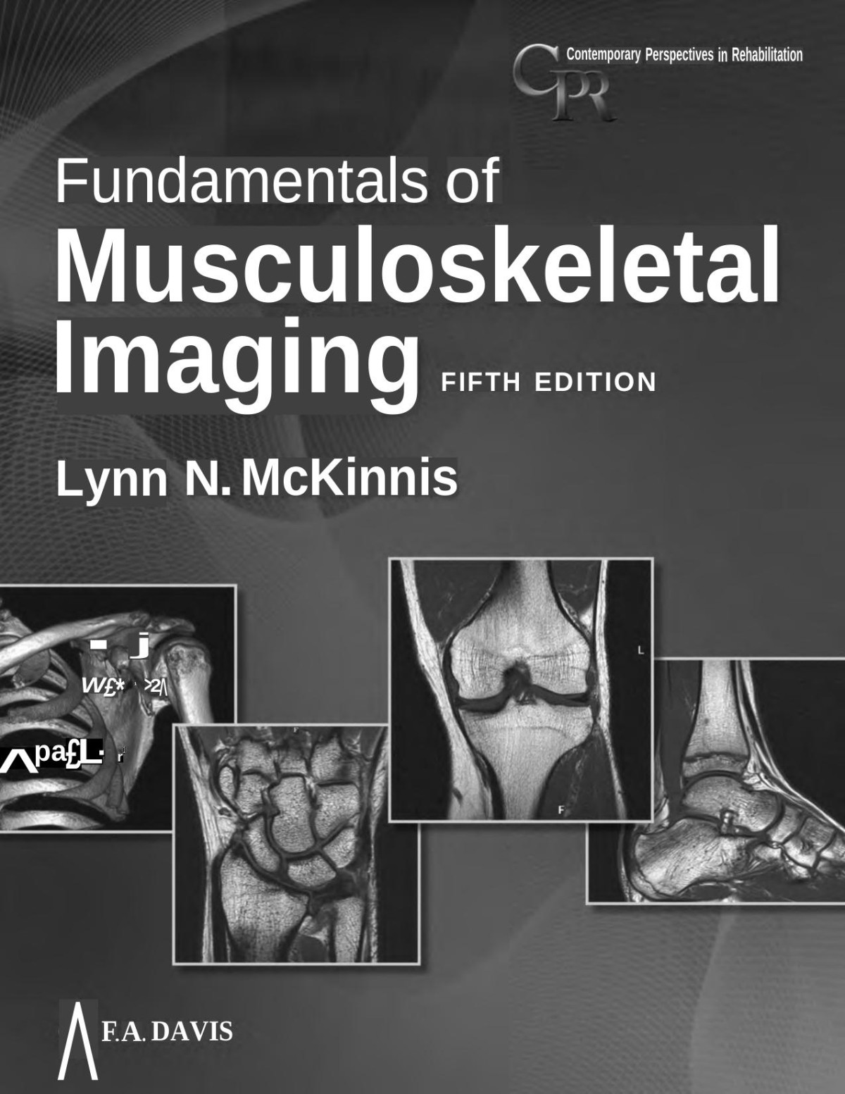 Fundamentals Of Musculoskeletal Imaging Contemporary Perspectives In Rehabilitation 5e Lynn N Mckinnis