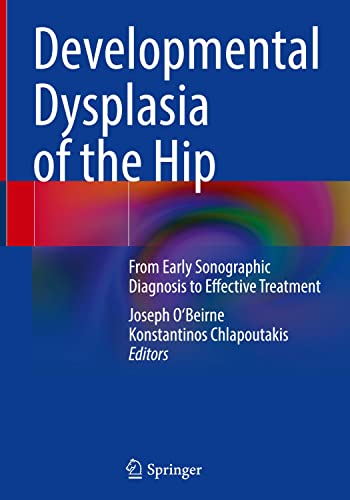 Developmental Dysplasia Of The Hip From Early Sonographic Diagnosis To Effective Treatment Joseph Obeirne