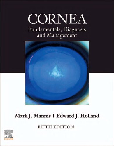 Cornea 2volume Set 5th Edition Mark J Mannis Md Facs Mark J Mannis