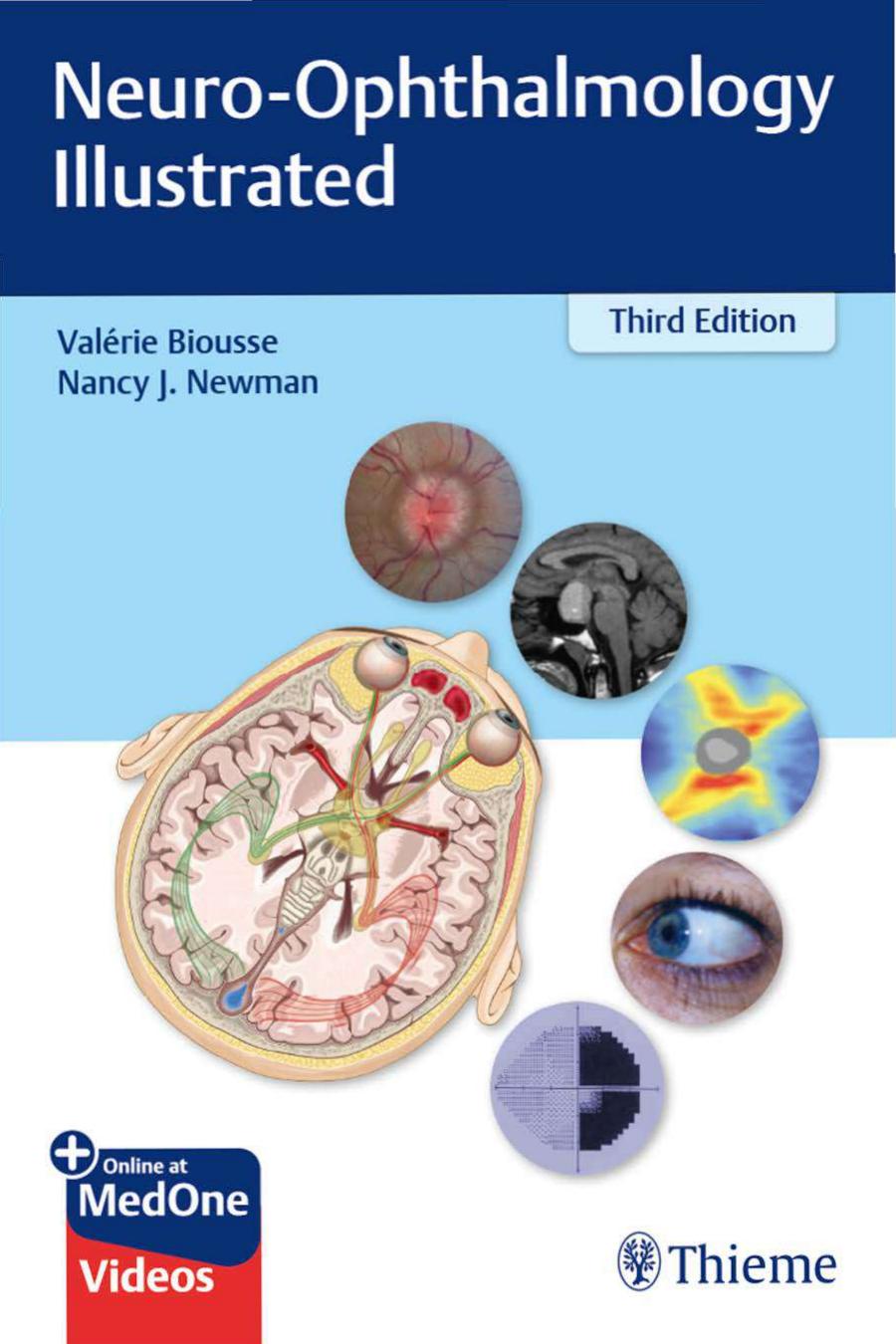 Neuroophthalmology Illustrated 3rd Edition Valerie Biousse Nancy Newman