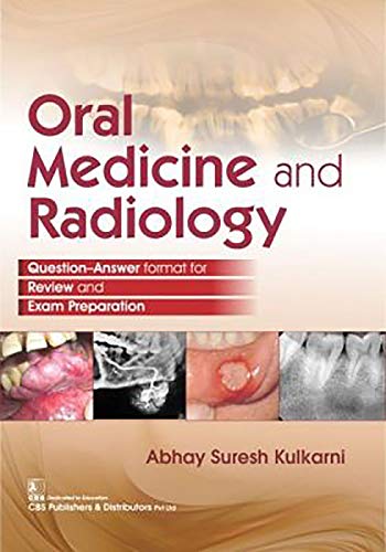 Oral Medicine And Radiology Abhay Suresh Kulkarni
