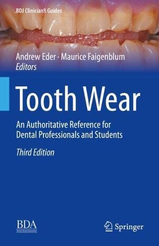 Tooth Wear An Authoritative Reference For Dental Professionals And Students 3rd Ed 2022 Andrew Eder