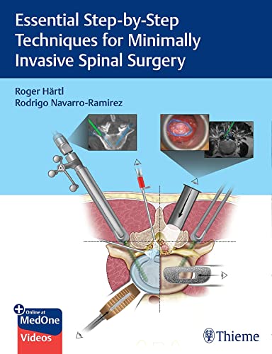 Essential Stepbystep Techniques For Minimally Invasive Spinal Surgery 1st Edition Roger Hartl
