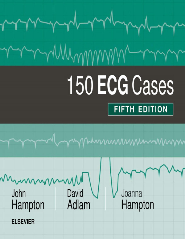 150 Ecg Cases Fifth Edition 5th Edition John Hampton David Adlam