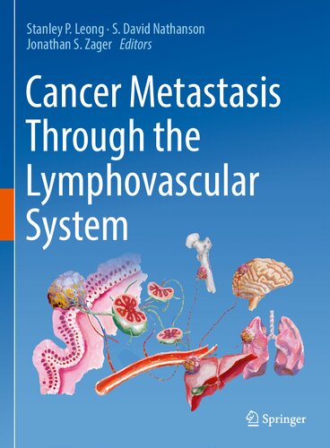 Cancer Metastasis Through The Lymphovascular System Stanley P Leong