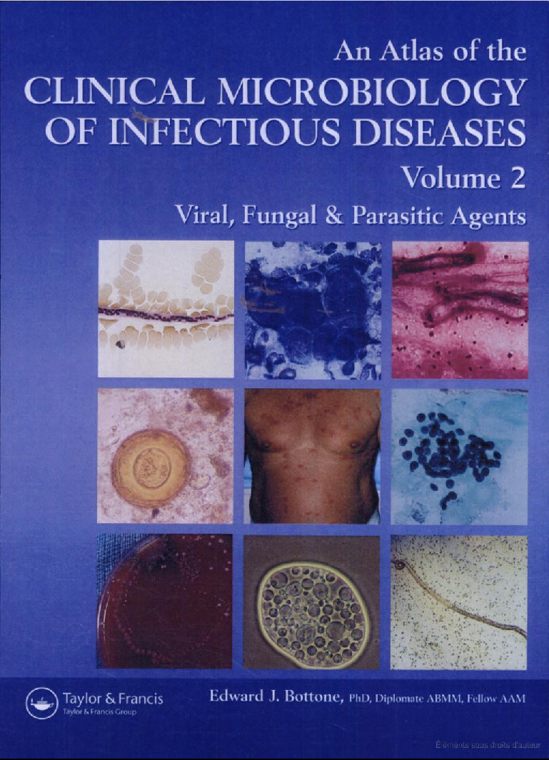 An Atlas Of The Clinical Microbiology Of Infectious Diseases Volume 2 Viral Fungal Parasitic Agents Edward J Bottone