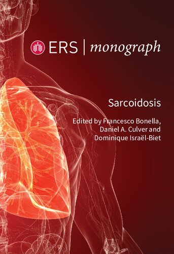 Sarcoidosis Francesco Bonella Daniel A Culver Dominique Isralbiet