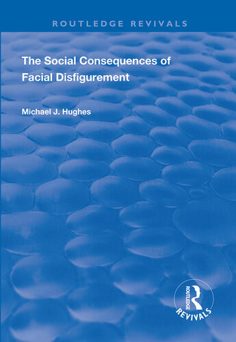 The Social Consequences Of Facial Disfigurement Michael J Hughes