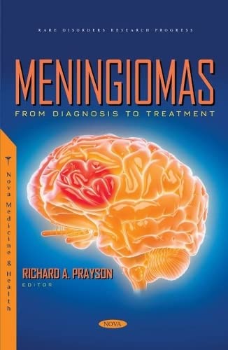 Meningiomas From Diagnosis To Treatment Richard A Prayson