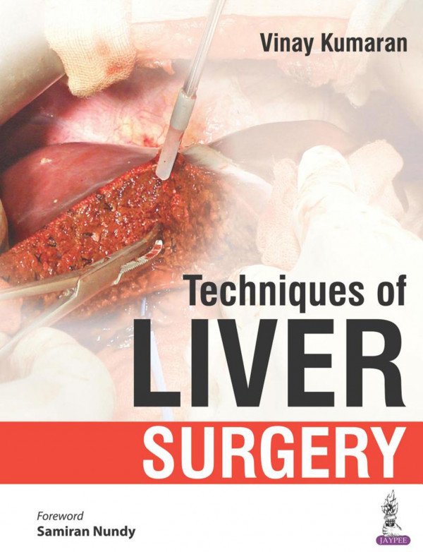 Techniques Of Liver Surgery Vinay Kumaran