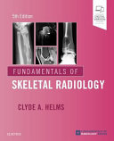 Fundamentals Of Skeletal Radiology 5th Edition 5th Edition Clyde A Helms