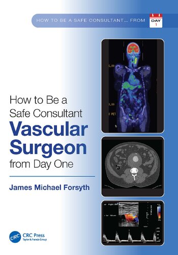 How To Be A Safe Consultant Vascular Surgeon From Day One The Unofficial Guide To Passing The Frcs Vasc James Michael Forsyth