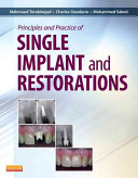 Principles And Practice Of Single Implant And Restoration Mahmoud Torabinejad