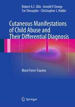 Cutaneous Manifestations Of Child Abuse And Their Differential Diagnosis Blunt Force Trauma 1st Edition Robert Ac Bilo