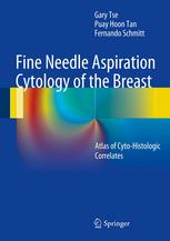 Fine Needle Aspiration Cytology Of The Breast Atlas Of Cytohistologic Correlates 1st Edition Gary Tse