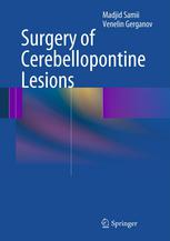 Surgery Of Cerebellopontine Lesions 1st Edition Madjid Samii