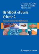 Handbook Of Burns Reconstruction And Rehabilitation Volume 2 1st Edition Sherri Sharp