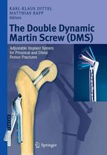 The Double Dynamic Martin Screw Dms Adjustable Implant System For Proximal And Distal Femur Fractures 1st Edition Prof K K Dittel Md Auth