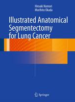 Illustrated Anatomical Segmentectomy For Lung Cancer 1st Edition Hiroaki Nomori