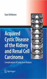 Acquired Cystic Disease Of The Kidney And Renal Cell Carcinoma Complications Of Longterm Dialysis 1st Edition Isao Ishikawa Md Auth