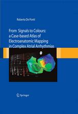 From Signals To Colours A Casebased Atlas Of Electroanatomic Mapping In Complex Atrial Arrhythmias 1st Edition Roberto De Ponti Auth