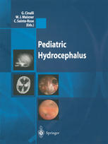 Pediatric Hydrocephalus 1st Edition Peter B Dirks Auth Giuseppe Cinalli Md