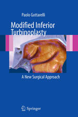Modified Inferior Turbinoplasty A New Surgical Approach 1st Edition Paolo Gottarelli Auth