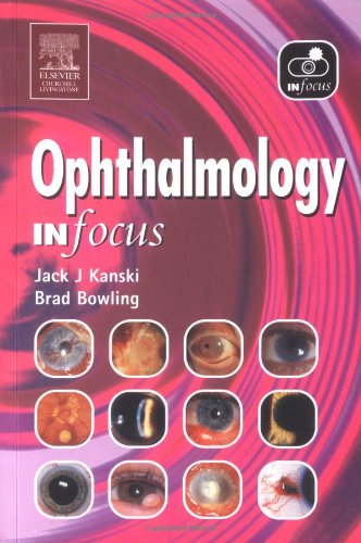 Ophthalmology In Focus 1e 1st Edition Jack J Kanski Md Ms Frcs Frcophth