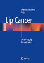 Lip Cancer Treatment And Reconstruction 1st Edition Michael Han Dds