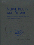 Nerve Injury And Repair Regeneration Reconstruction And Cortical Remodeling Gran Lundborg